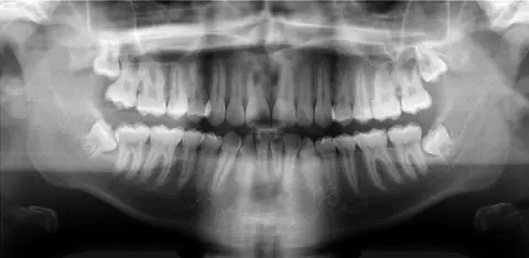 Radiografía panorámica de ejemplo